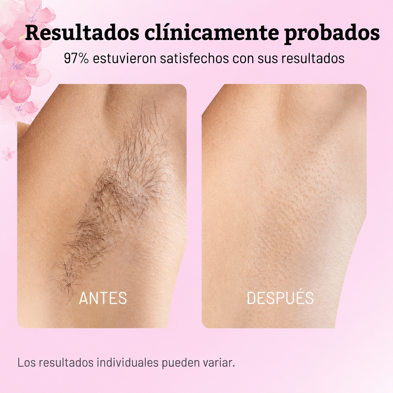 Caramela Beauty - Aceite de Cyperus Rotundus – Aceite Natural para Reducir el Crecimiento del Vello | 60 mL