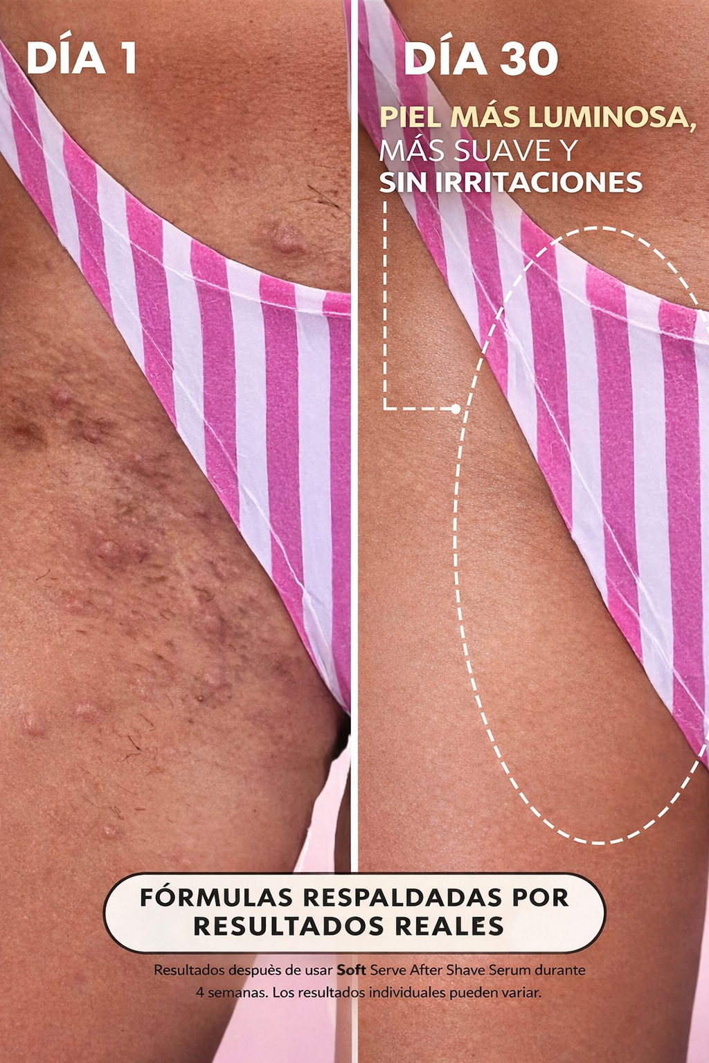 Truly Soft Serve 90 ml – Hidratante Íntimo Calmante y Refrescante