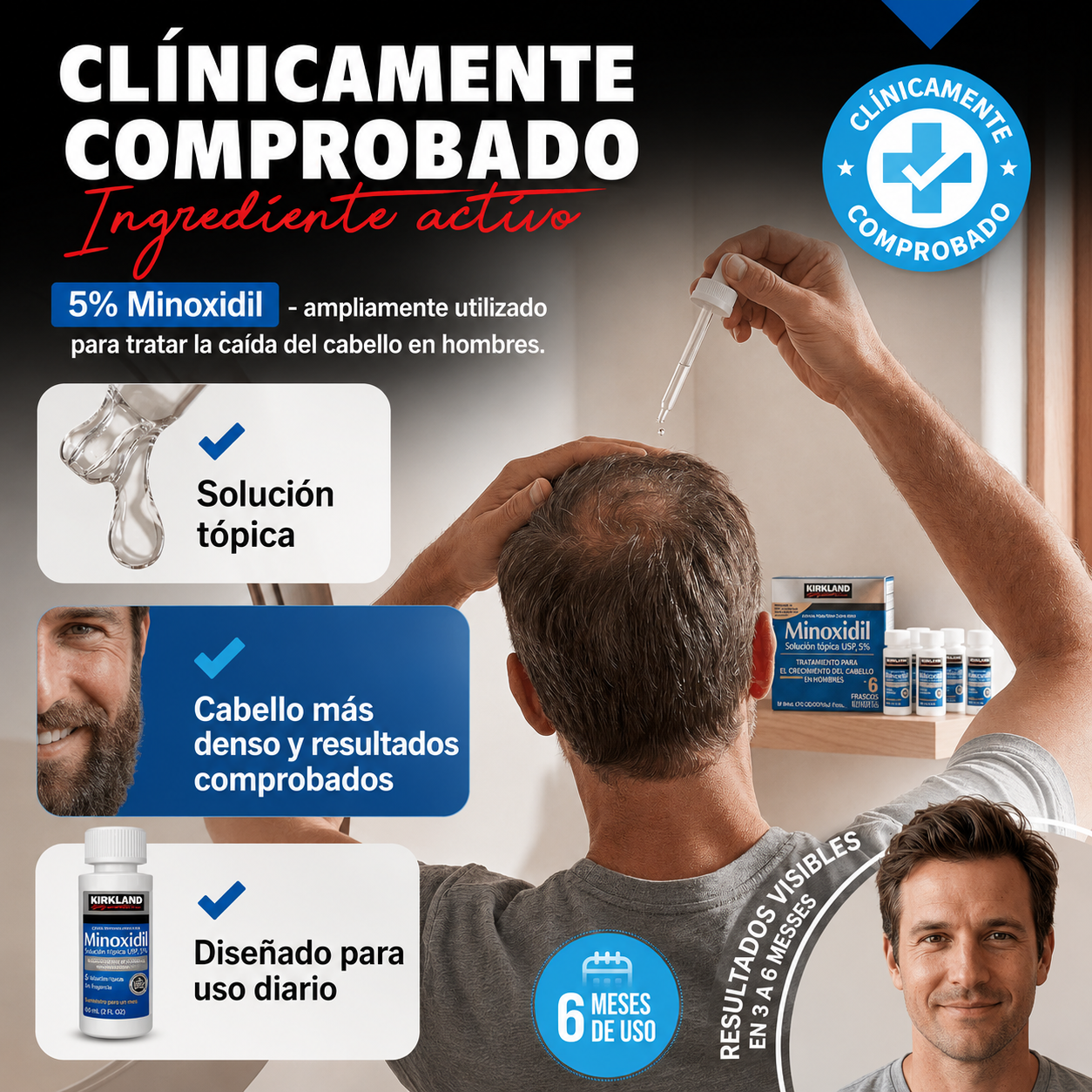 Kirkland - Minoxidil Líquido para Hombre - Tratamiento para la Regeneración Capilar, Vello Facial y Corporal de Alta Potencia al 5 % | 60 mL